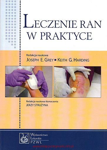 Leczenie ran w praktyce Grey