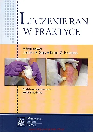 Leczenie ran w praktyce Grey
